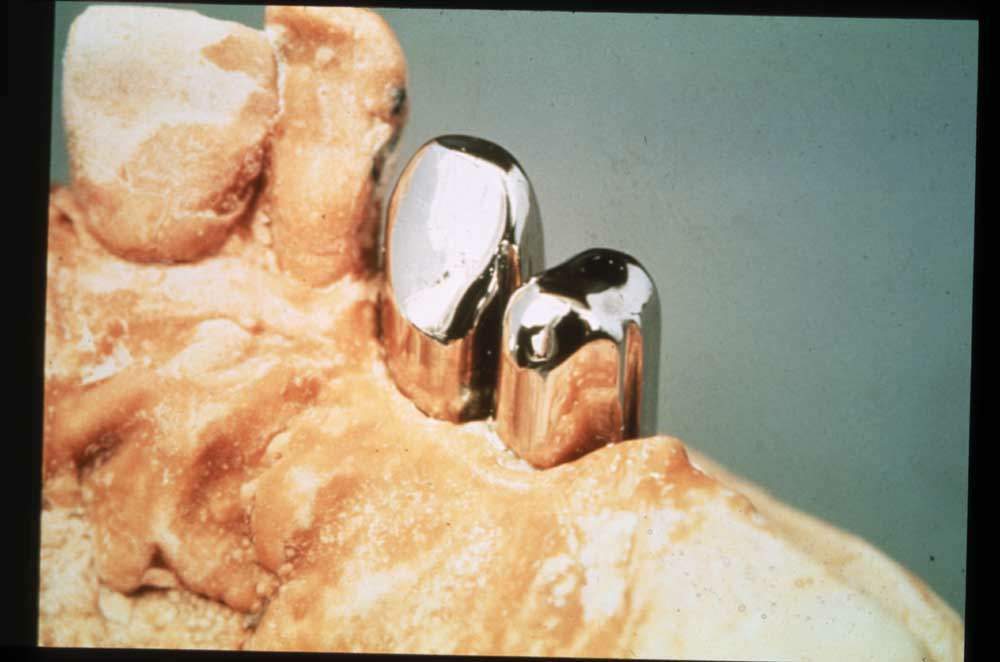 doppie su part copia.JPG (48945 byte)