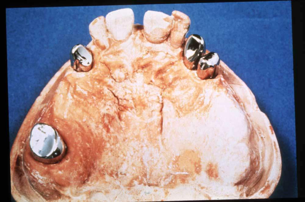 doppie sup nosck copia.JPG (66455 byte)