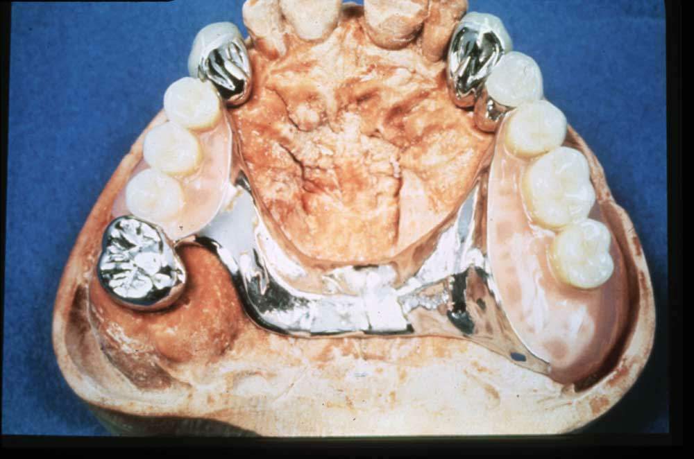 doppie+sck sup copia.JPG (64561 byte)