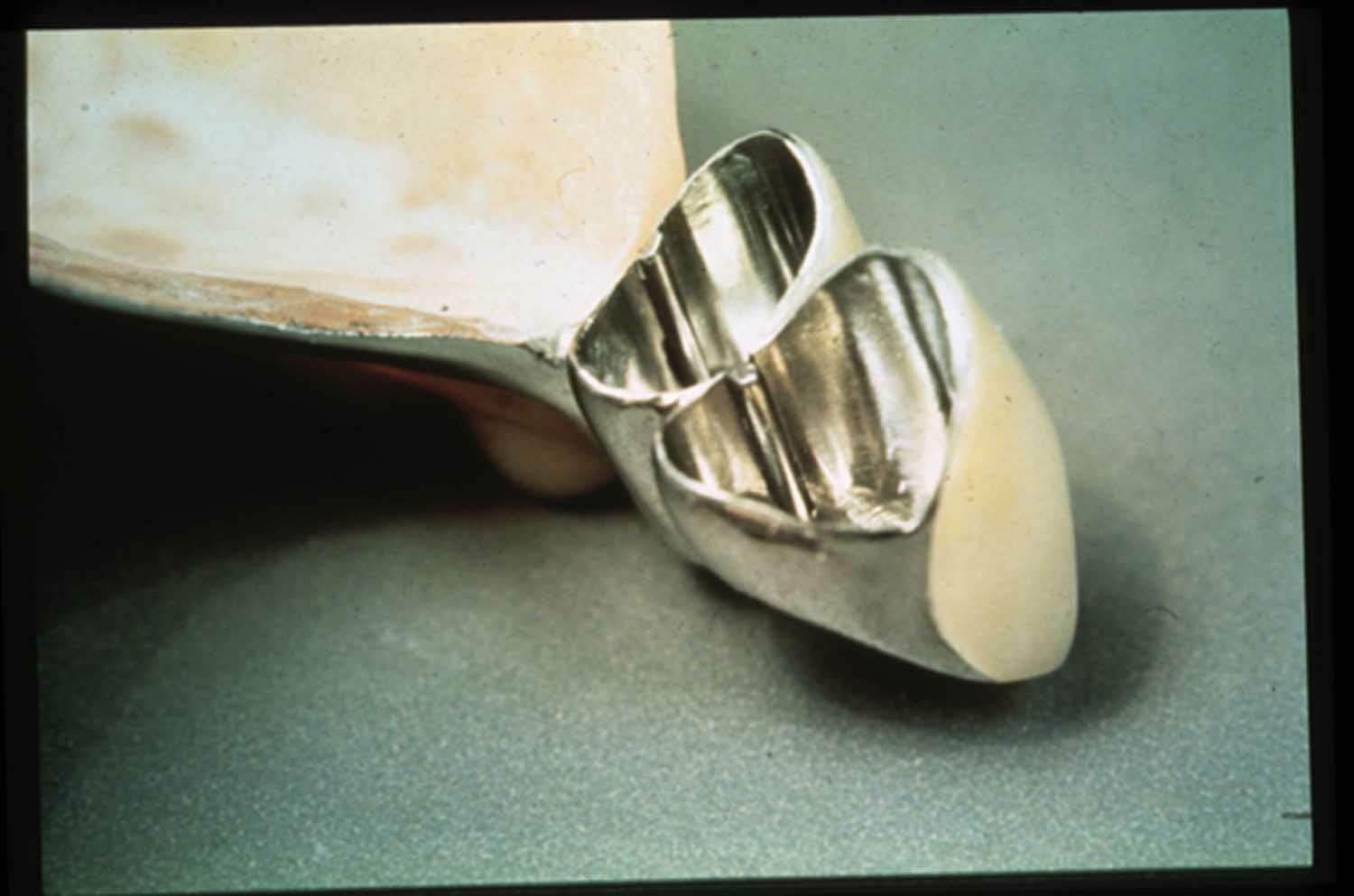 part sec dopsup copia.JPG (71546 byte)